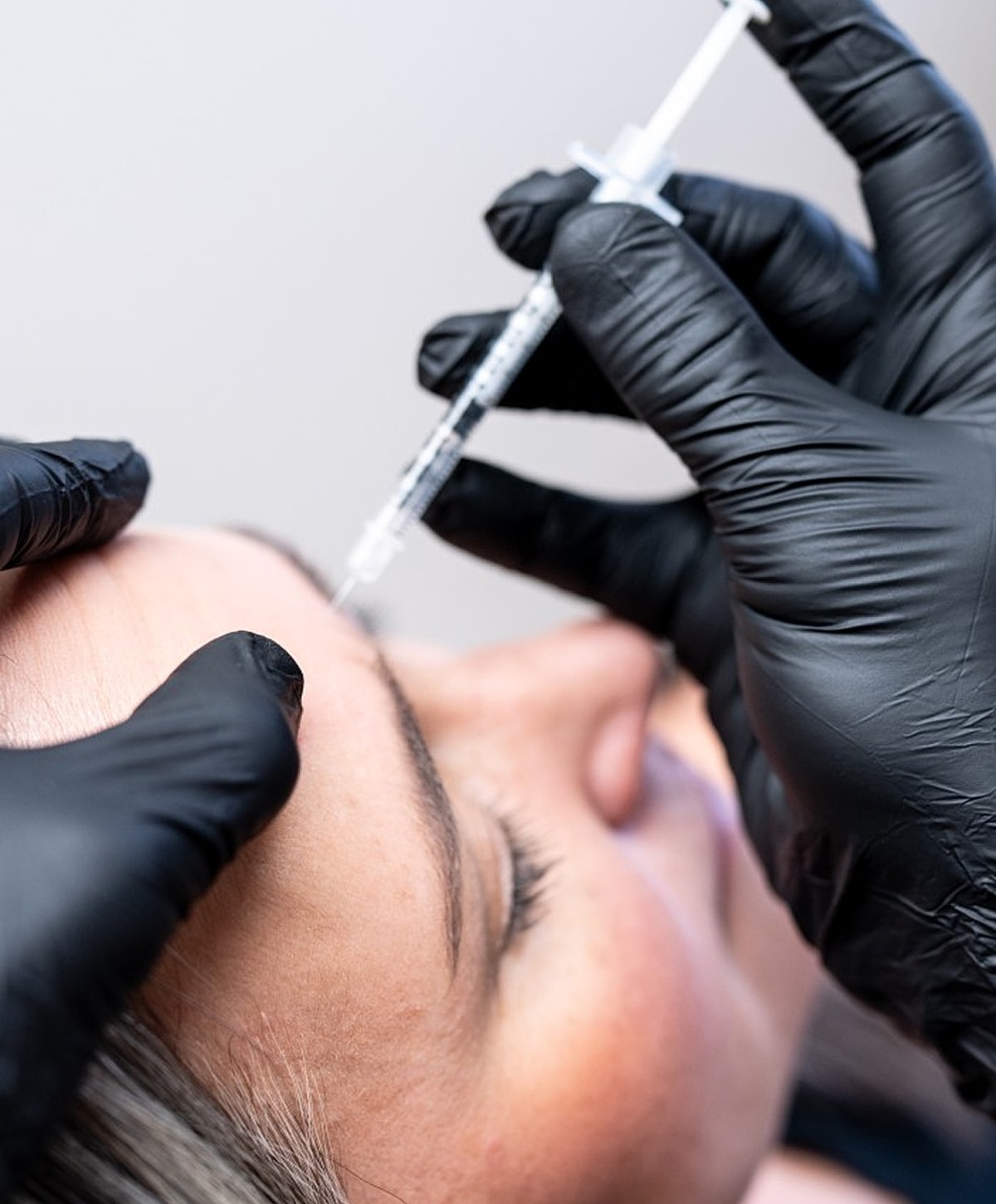 Administering a cosmetic injection on forehead.