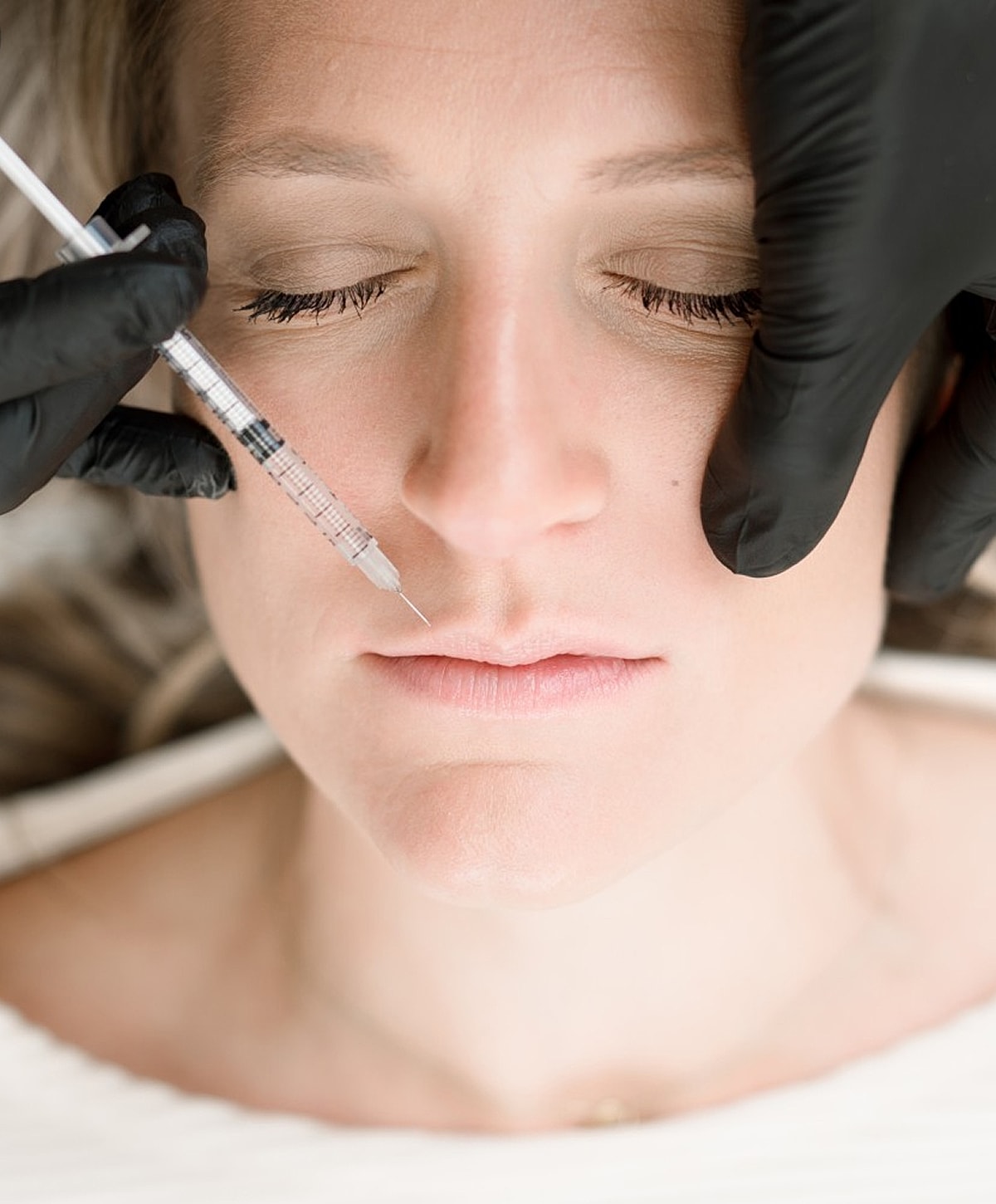 Dermal filler application on a woman's face.