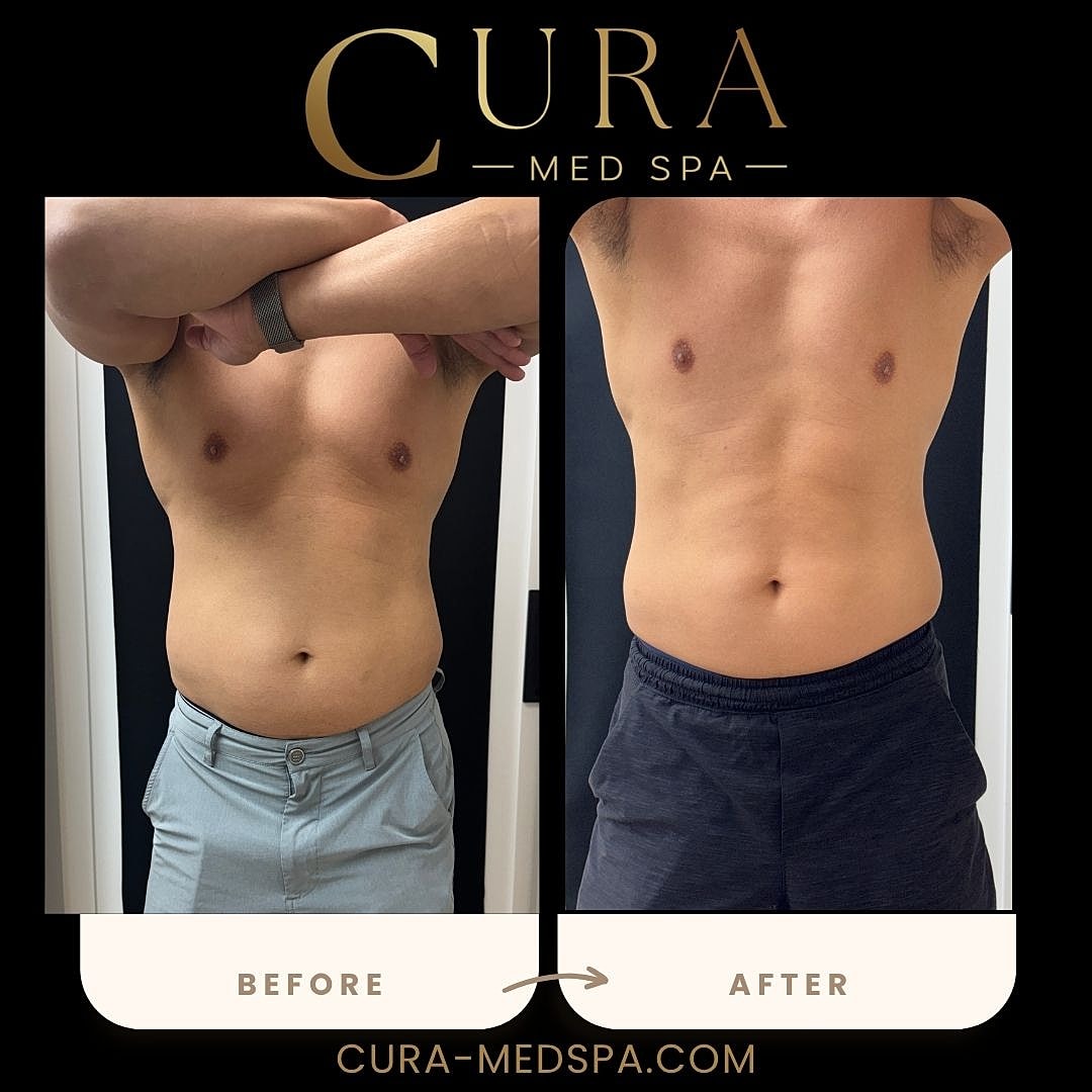 Body Sculpting (Weight Loss) Gallery Before & After