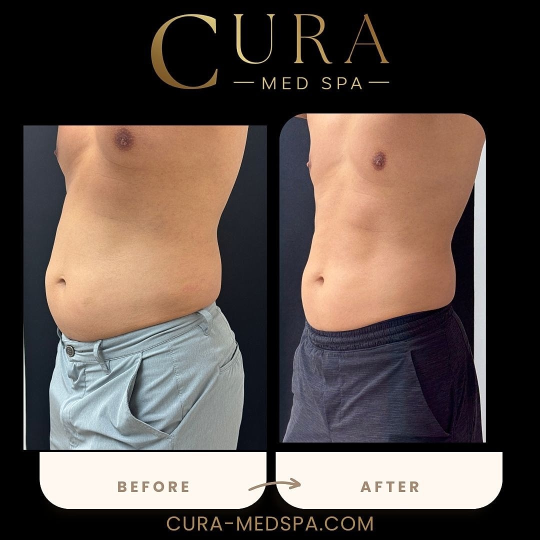 Body Sculpting (Weight Loss) Gallery Before & After