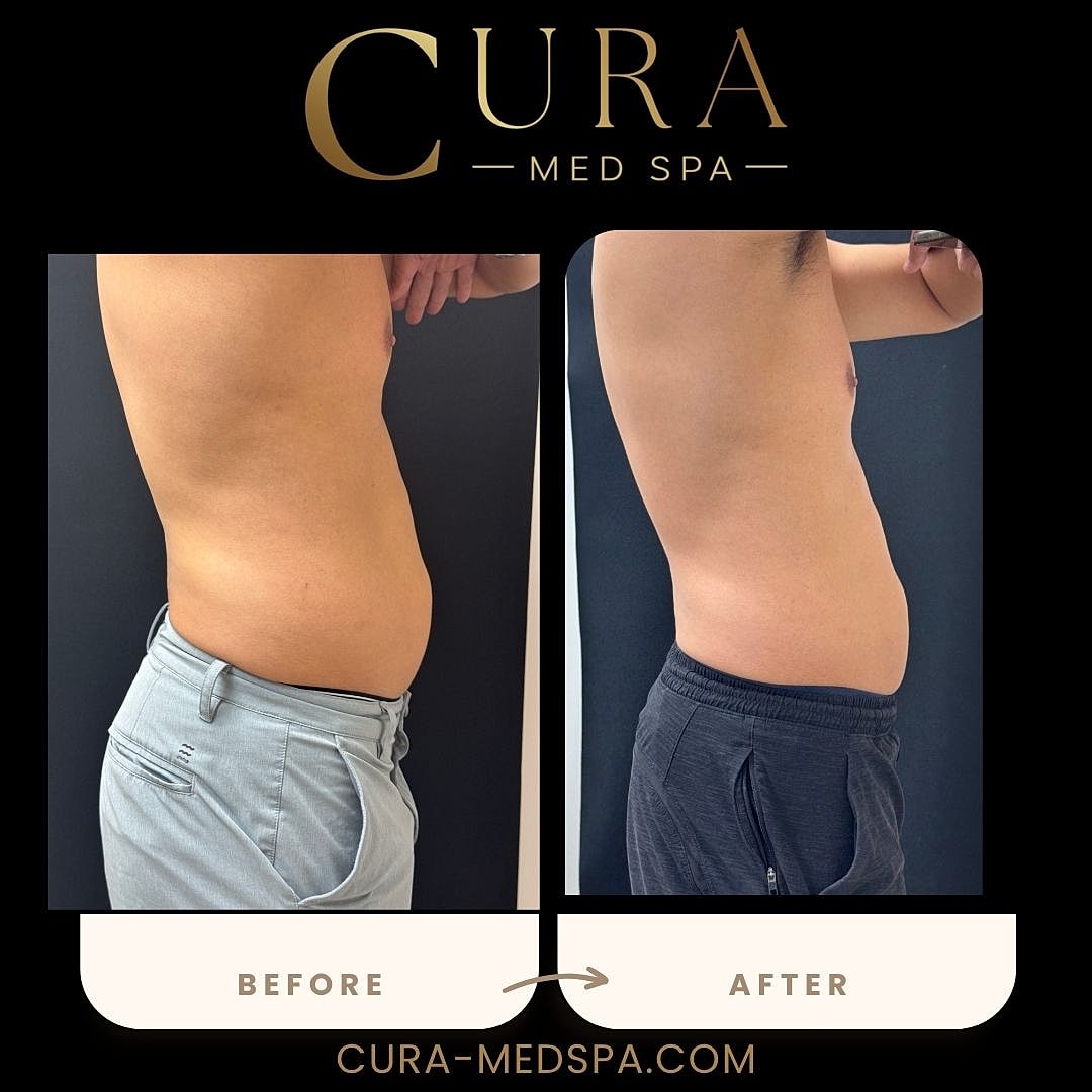 Body Sculpting (Weight Loss) Gallery Before & After